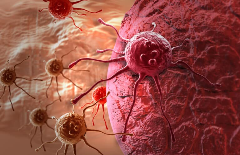 Cancer cells invading healthy tissue illustration.